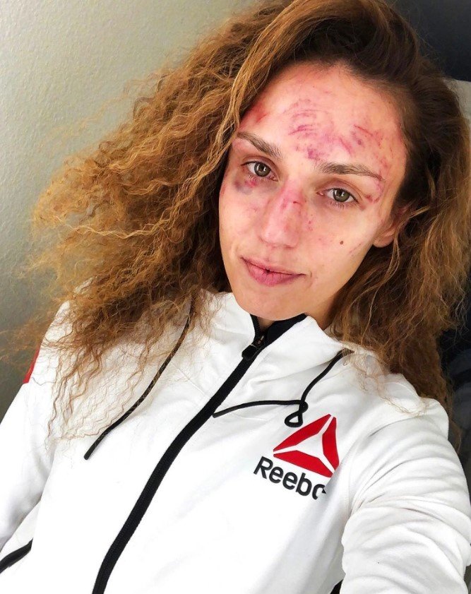 Önce yumruk yedi, sonra kardeşinin yüzünü öyle bir hale soktu ki...