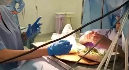 Beyin ameliyatı olurken dolma hazırladı