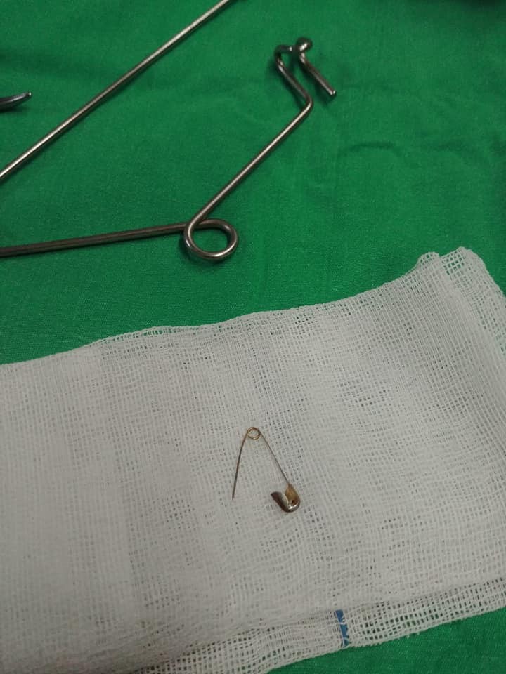 Tekirdağ'da korkunç olay! 7 aylık bebeğin yemek borusundan çengelli iğne çıktı