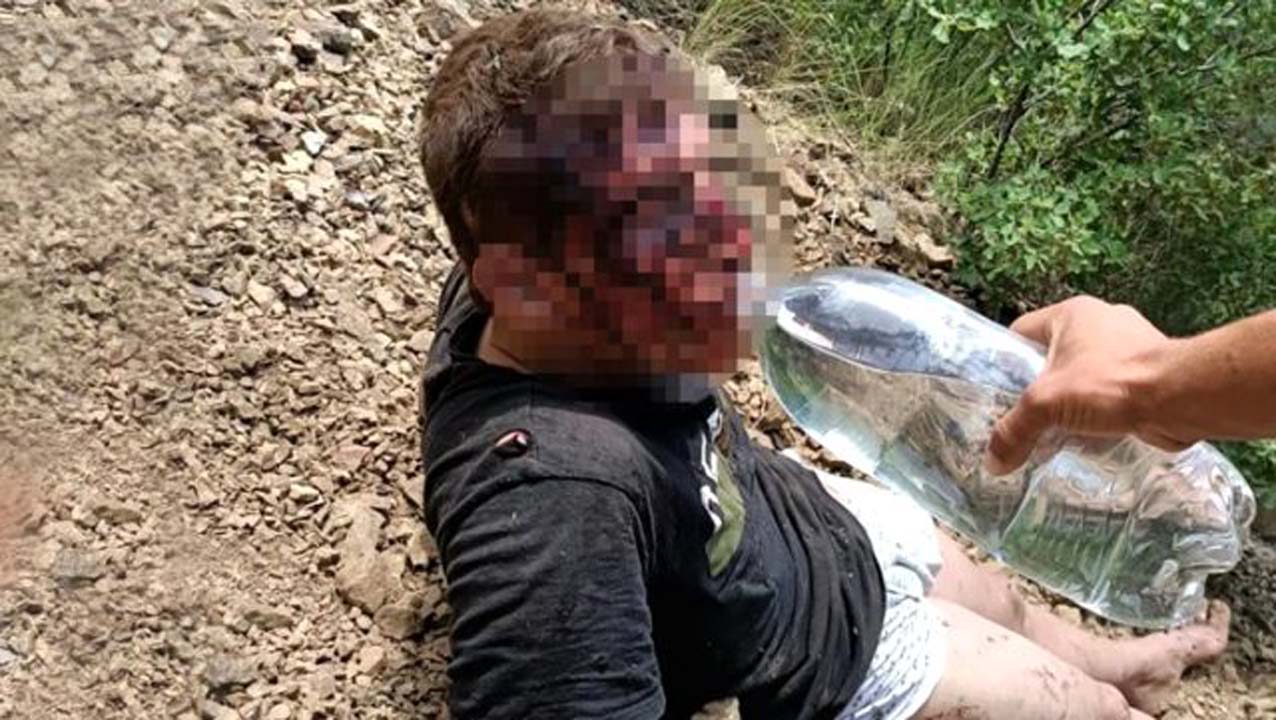 Dağda ayakları kırılmış halde bulunan gencin inanılmaz hikayesi!