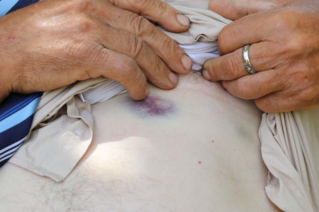 Borç yüzünden kaçırılıp darp edilen çiftçi: ''Boğazıma balta dayayıp, tehdit ettiler"