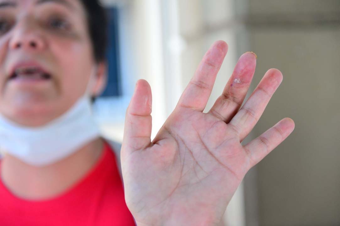 Eşi tarafından 9 yerinden bıçaklanan kadın: 'Beni öldürdükten sonra mı ceza verecekler?'