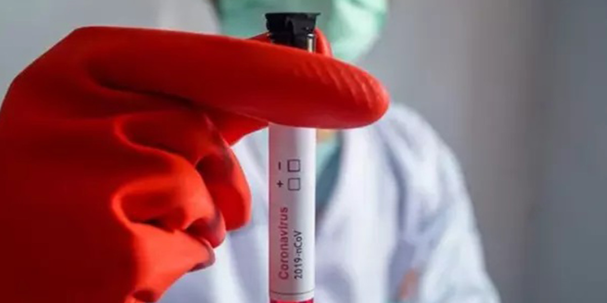 DSÖ'den koronavirüs ile ilgili korkutan açıklama: "Çok fazla ülke yanlış istikamete gidiyor"