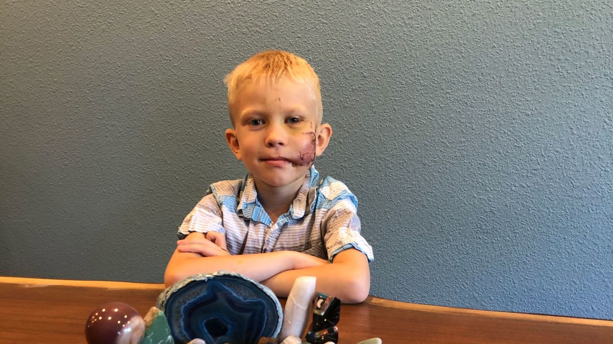 Kardeşini köpek saldırısından kurtarmak için kendini feda etti!