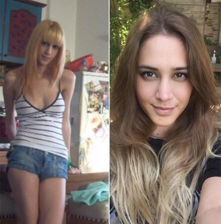 Ünlü oyuncuyu görenler tanıyamadı!