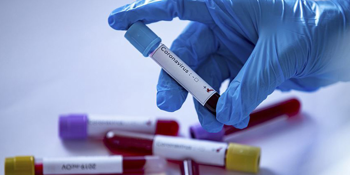 Valilik açıkladı! Bir ilimizde 191 ev karantinaya alındı