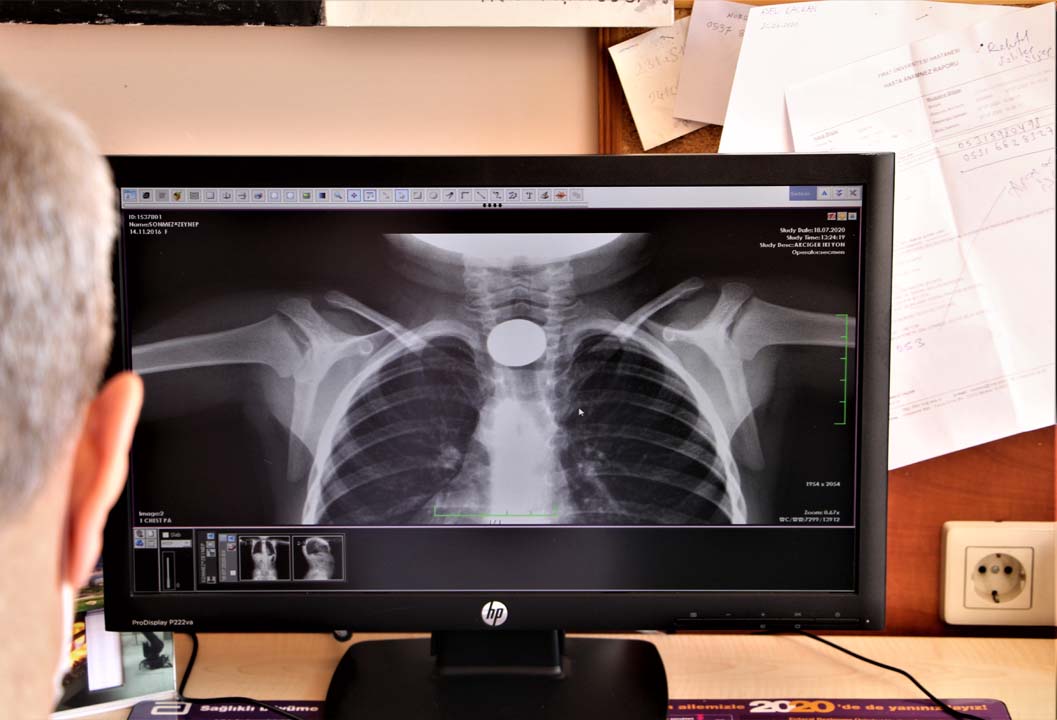 Elazığ'da son iki yılda çocukların midesinden çıkanlar görenleri şaşırttı!