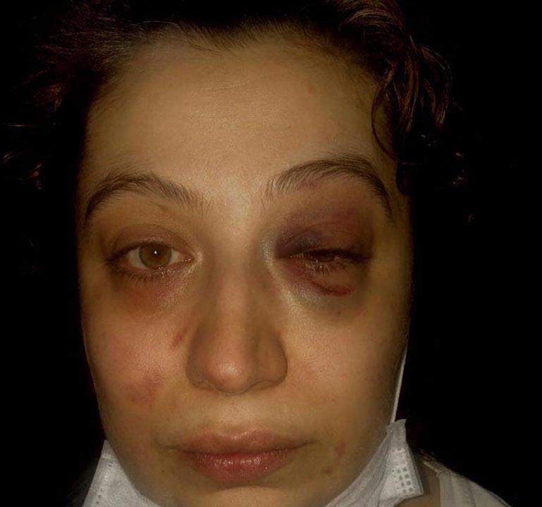 Kendini polis gibi gösteren eski eş, kadına dehşeti yaşattı!