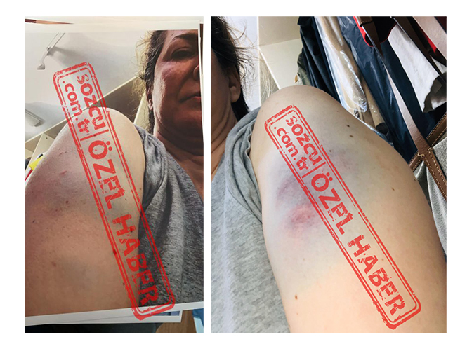 Mert Çiller kimdir? Kaç yaşında? Şiddet iddiası gerçek mi?