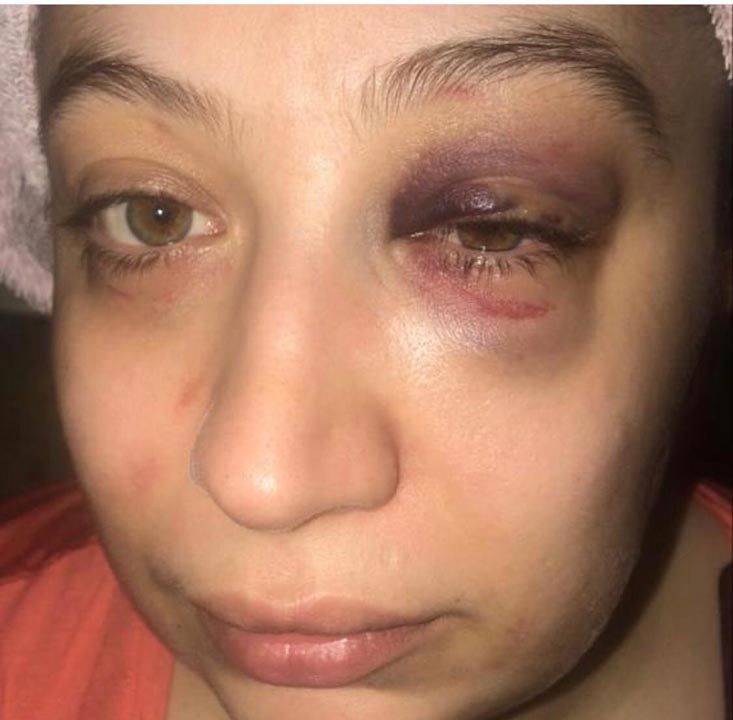 Kendini polis gibi gösteren eski eş, kadına dehşeti yaşattı!