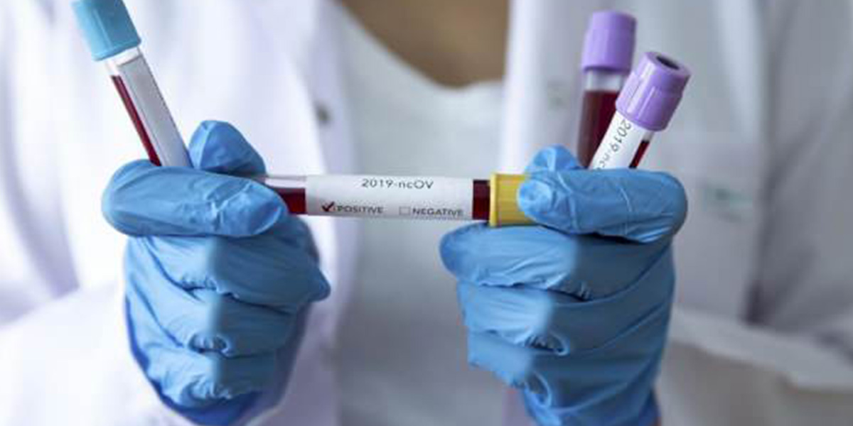 3 hafta öncesine kadar vaka olmayan ilçede koronavirüs hızla yayılıyor