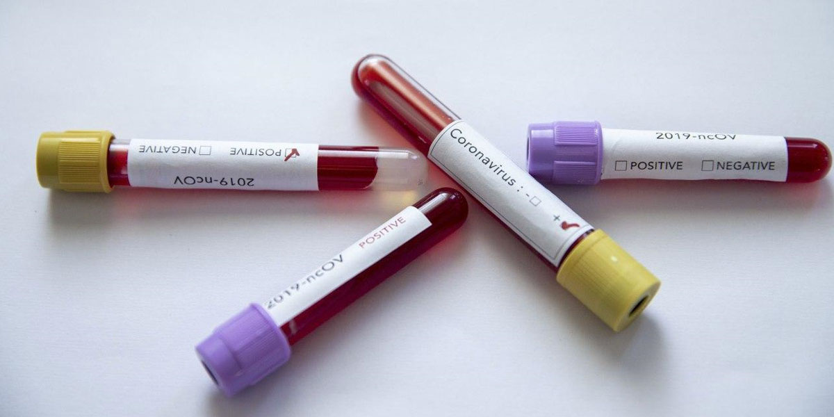 3 hafta öncesine kadar vaka olmayan ilçede koronavirüs hızla yayılıyor