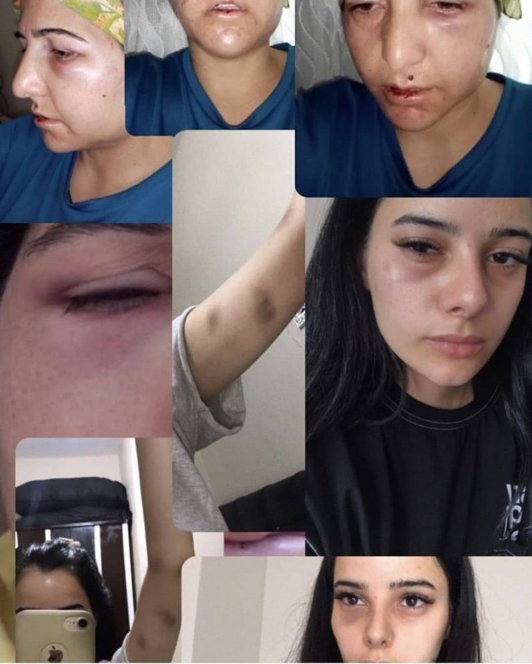 Kızını ve eşini sabaha kadar dövdü! Genç kadın isyan etti!