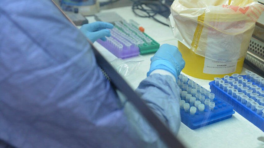 Koronavirüs Türkiye'de mutasyona mı uğradı? Bir ay sonra açıklanacak