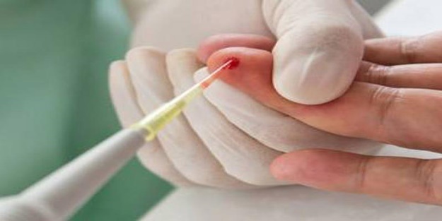 Anemi nedir? Kansızlık belirtileri ve tedavi yöntemleri nelerdir?