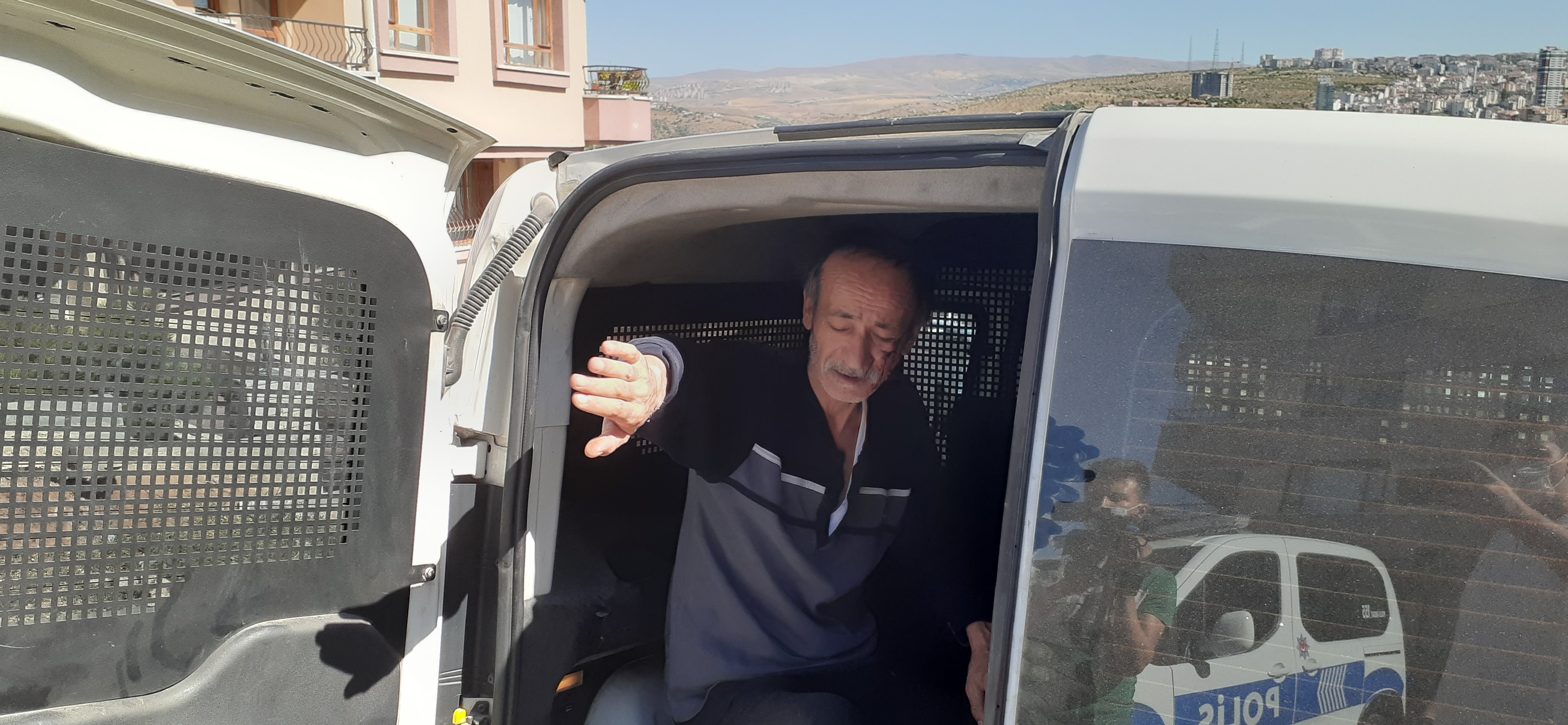 Hannibal karakteri gerçek oldu: Karısının parmağını ısırarak kopardı