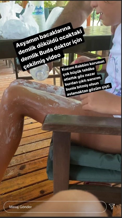 Yeliz Yeşilmen'in kızının bacaklarına çaydanlık döküldü!