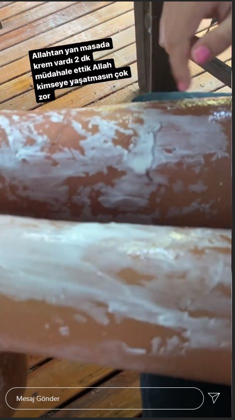 Yeliz Yeşilmen'in kızının bacaklarına çaydanlık döküldü!