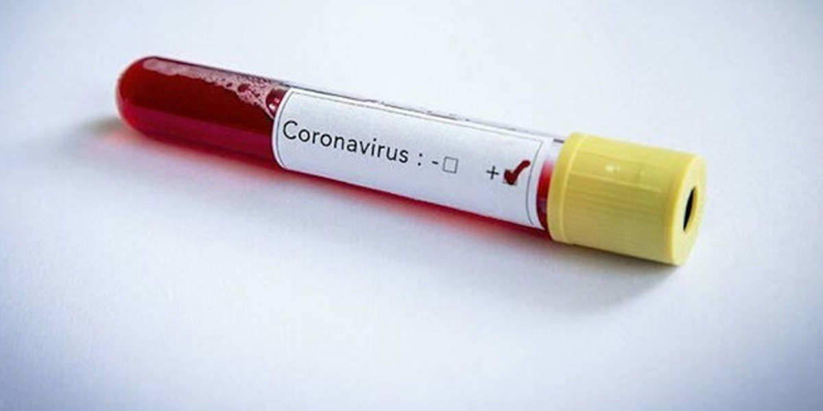 Fenerbahçe'de korona şoku!