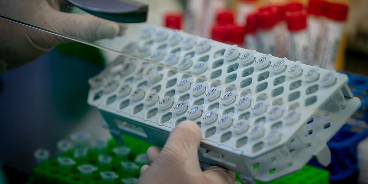 DSÖ açıkladı: Koronavirüs aşısı için dünya en az 100 milyar dolar harcamalı