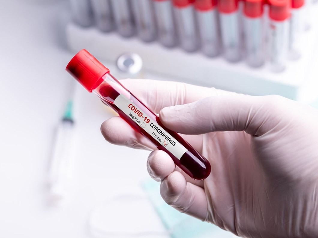 Samsun'dan kötü haber: Yoğun bakım üniteleri doldu