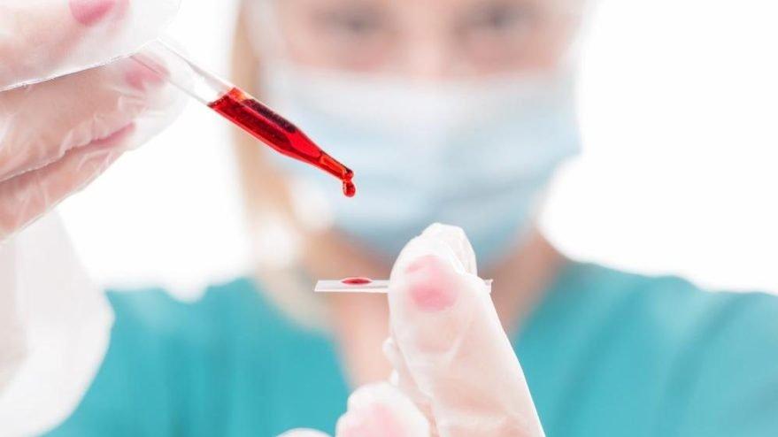 Hepatit B Nedir, Belirtileri Nelerdir? Hepatit B nasıl bulaşır?