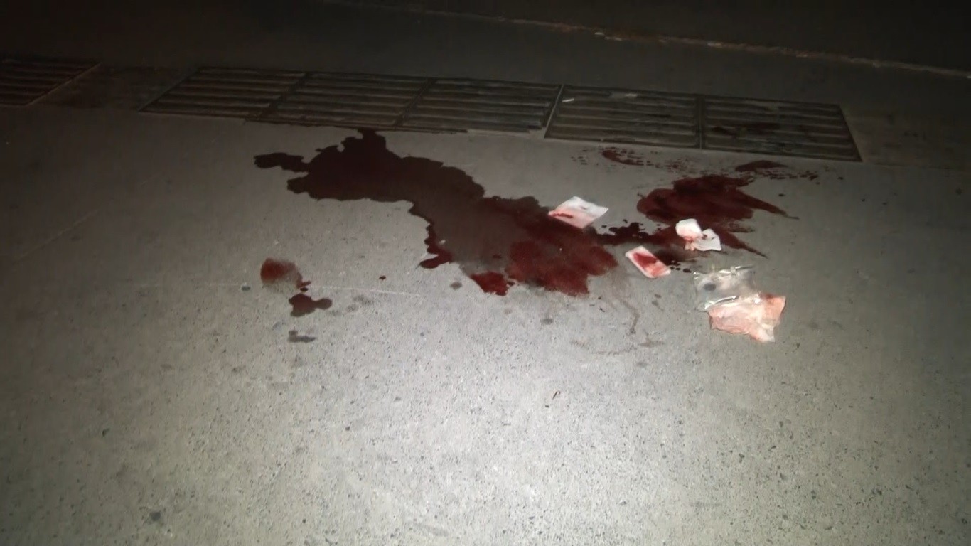 Eyüp’te iki grup arasında silahlı kavga: 1 yaralı