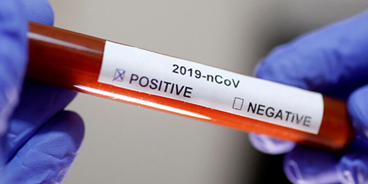 Koronavirüs ne zaman sona erecek? DSÖ'den flaş açıklama