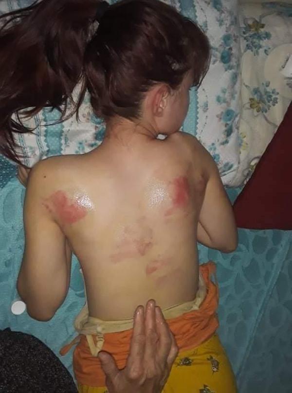 Telefon şifresini vermeyen 14 yaşındaki kızını ingiliz anahtarıyla dövdü