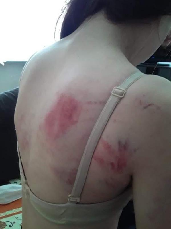 Telefon şifresini vermeyen 14 yaşındaki kızını ingiliz anahtarıyla dövdü