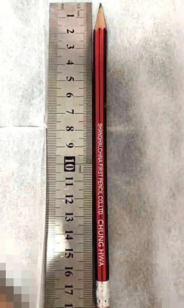 7 yaşındaki çocuğun boğazından 18 cm’lik kalem çıktı