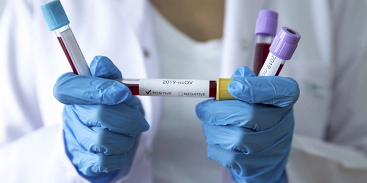 İYİ Partili isimden koronavirüse ilişkin flaş açıklama: 10'la çarpın