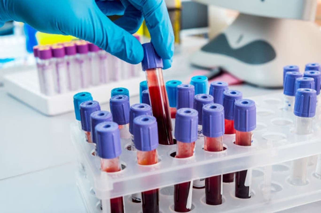 Virüs yayılıyor: 2 ilde daha karantina uygulaması