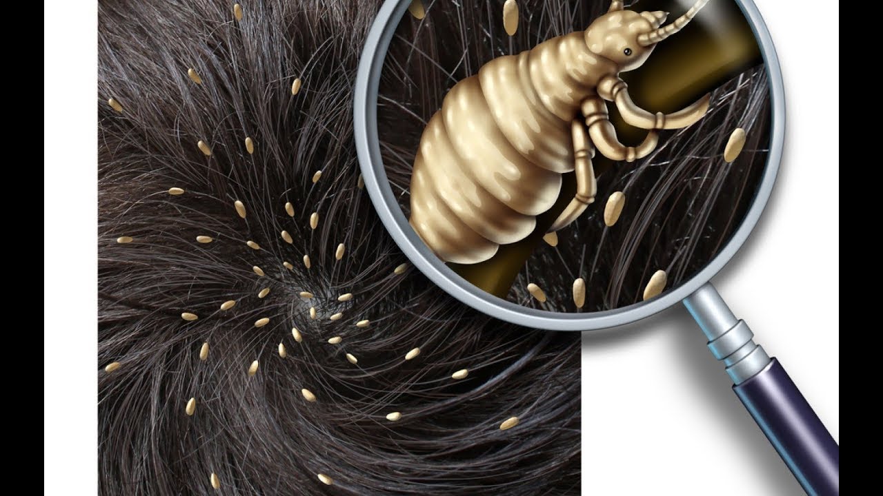 Bit nasıl bulaşır? Neden olur? Nasıl temizlenir?