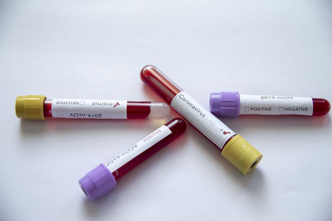 Kusmak corona belirtisi mi ? Kusmak Covid-19 belirtisi mi?