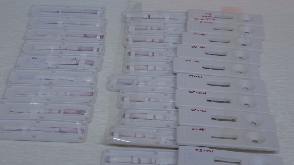 On Sekiz Mart Üniversitesi'nden 8 dakikada sonuç veren test kiti müjdesi