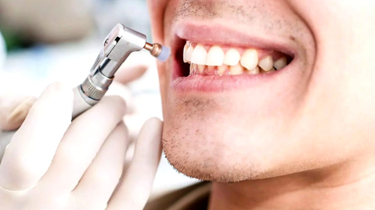 Kötü ağız hijyeni, erkeklerde sertleşme sorununu da beraberinde getiriyor