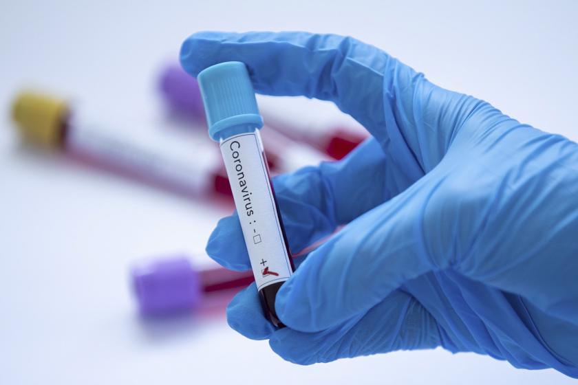 Niğde'de karantina ihlali yapan 5 vatandaş yurda yerleştirildi