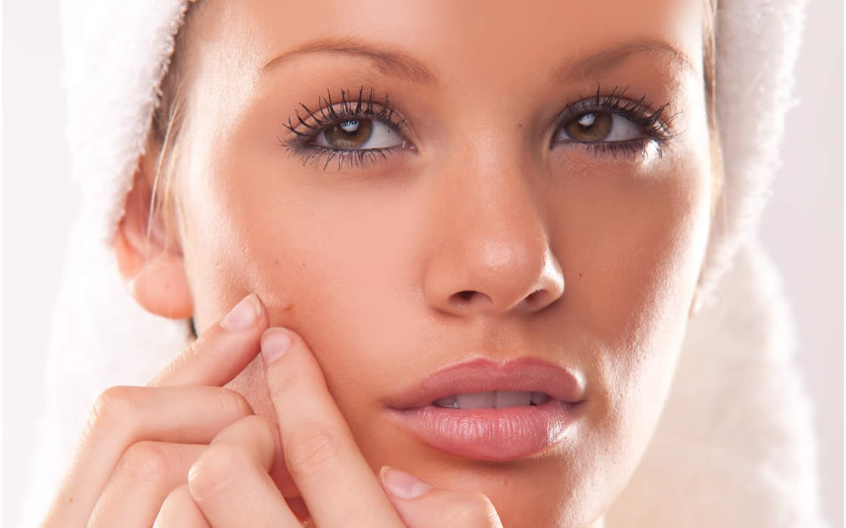 Sivilce nedir? Neden olur? Doğal yöntemlerle nasıl geçer? Sivilce izleri nasıl geçer?