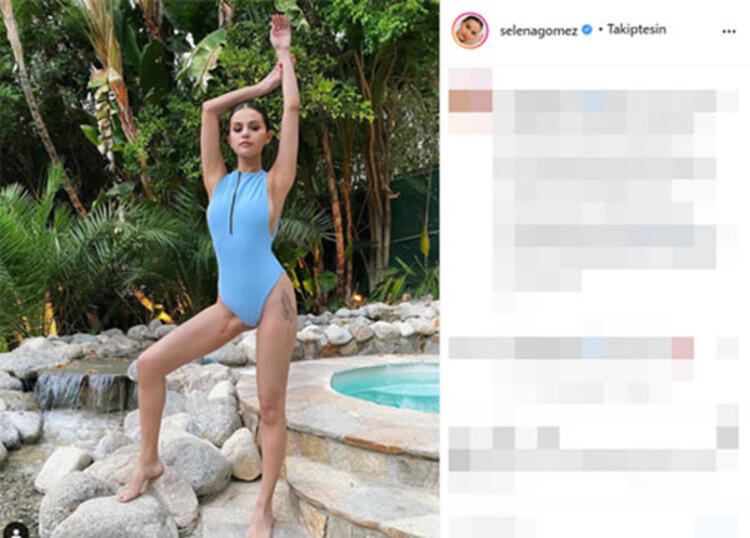 Selena Gomez ölümden döndüğü ameliyattan kalan yara izini gösterdi