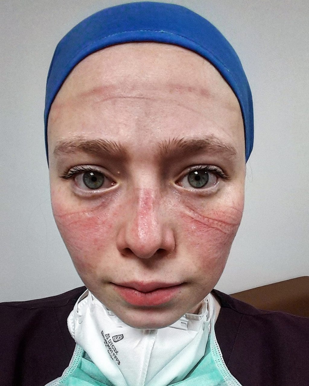 Yoğun bakımda çalışan Seher hemşireye övgü yağmuru