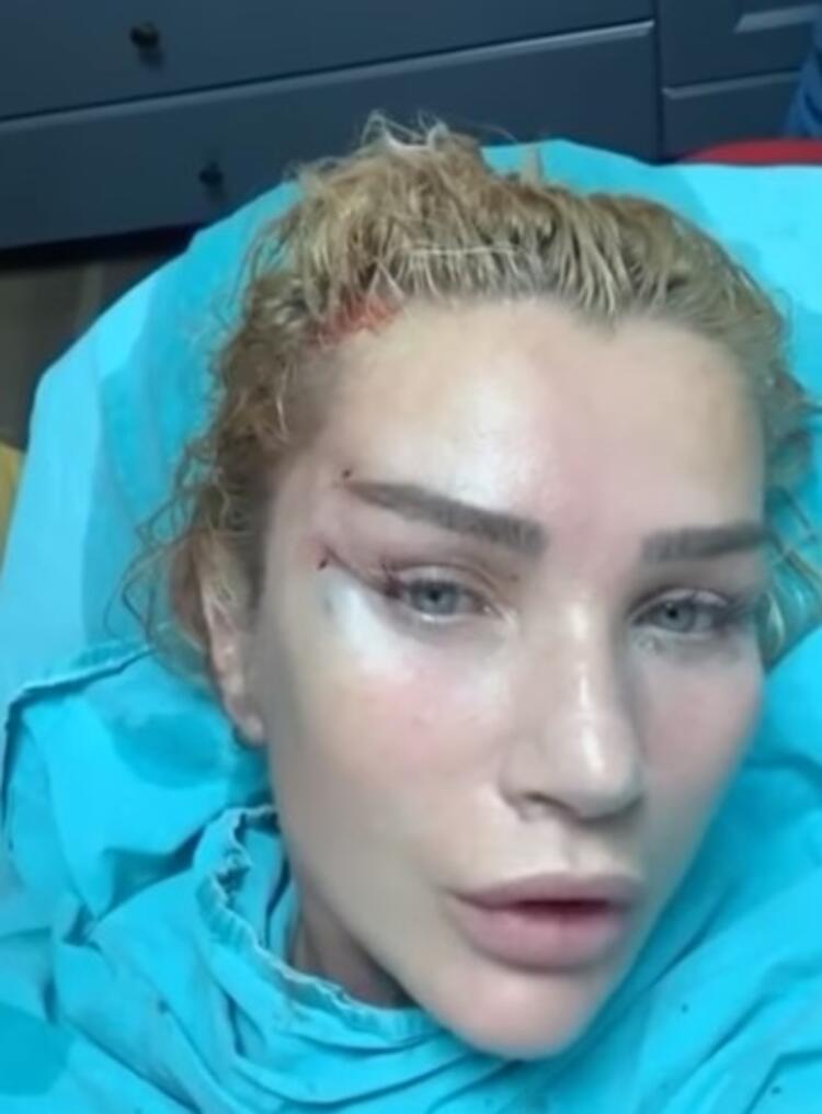 Seda Sayan 'Fransız askısı' yöntemi ile yüzünü gerdirdiği anları paylaştı!