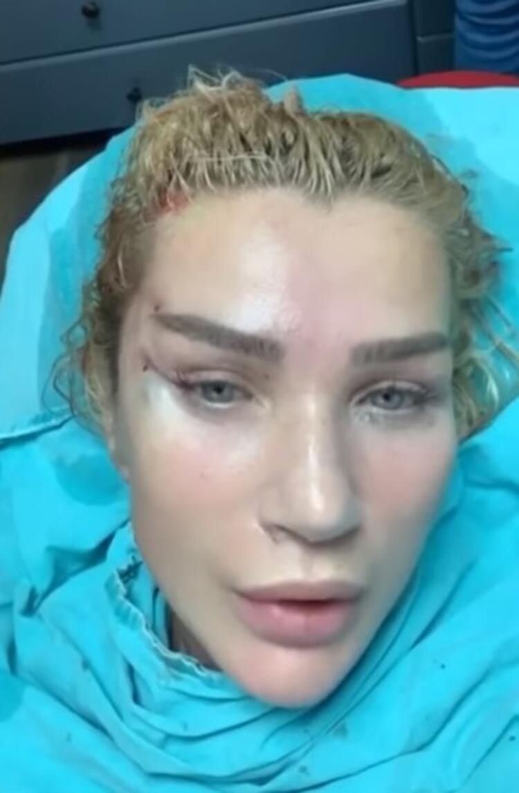 Seda Sayan 'Fransız askısı' yöntemi ile yüzünü gerdirdiği anları paylaştı!