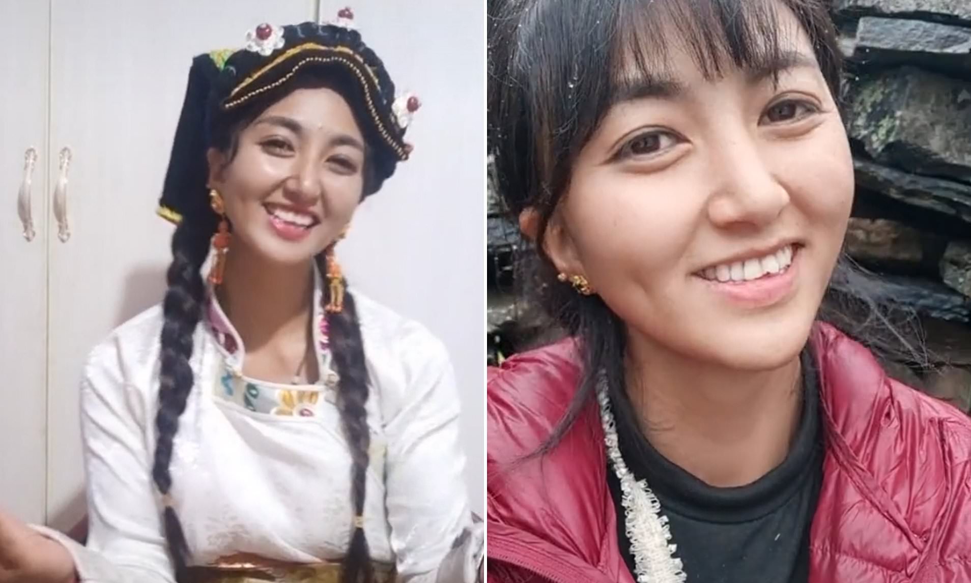 Korkunç olay! Sosyal medya fenomeni kocası tarafından yakıldı