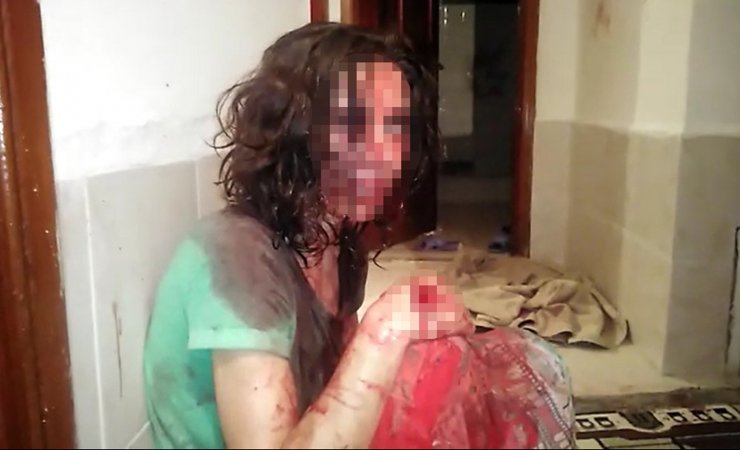 Eşini dövüp, polise direnen koca tutuklandı, kadın ise sığınma evine yerleştirildi