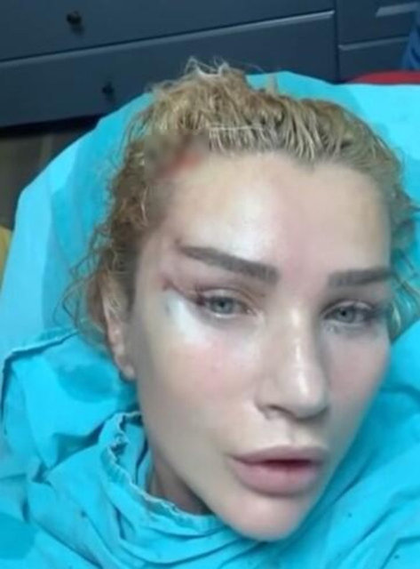 Seda Sayan'ın son hali! Estetik operasyon geçiren Seda Sayan'a ne oldu?