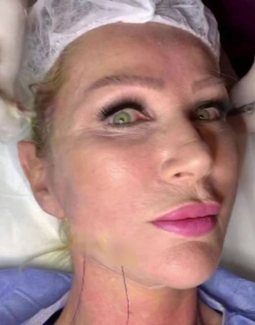 Seda Sayan'ın son hali! Estetik operasyon geçiren Seda Sayan'a ne oldu?