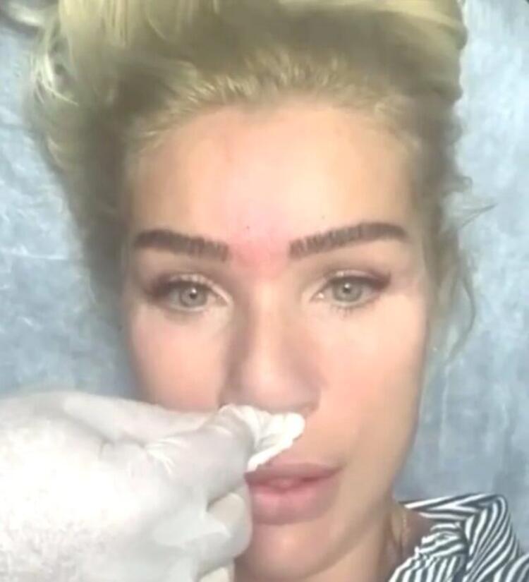 Seda Sayan'ın son hali! Estetik operasyon geçiren Seda Sayan'a ne oldu?