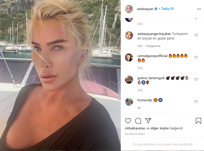 Seda Sayan'ın son hali! Estetik operasyon geçiren Seda Sayan'a ne oldu?