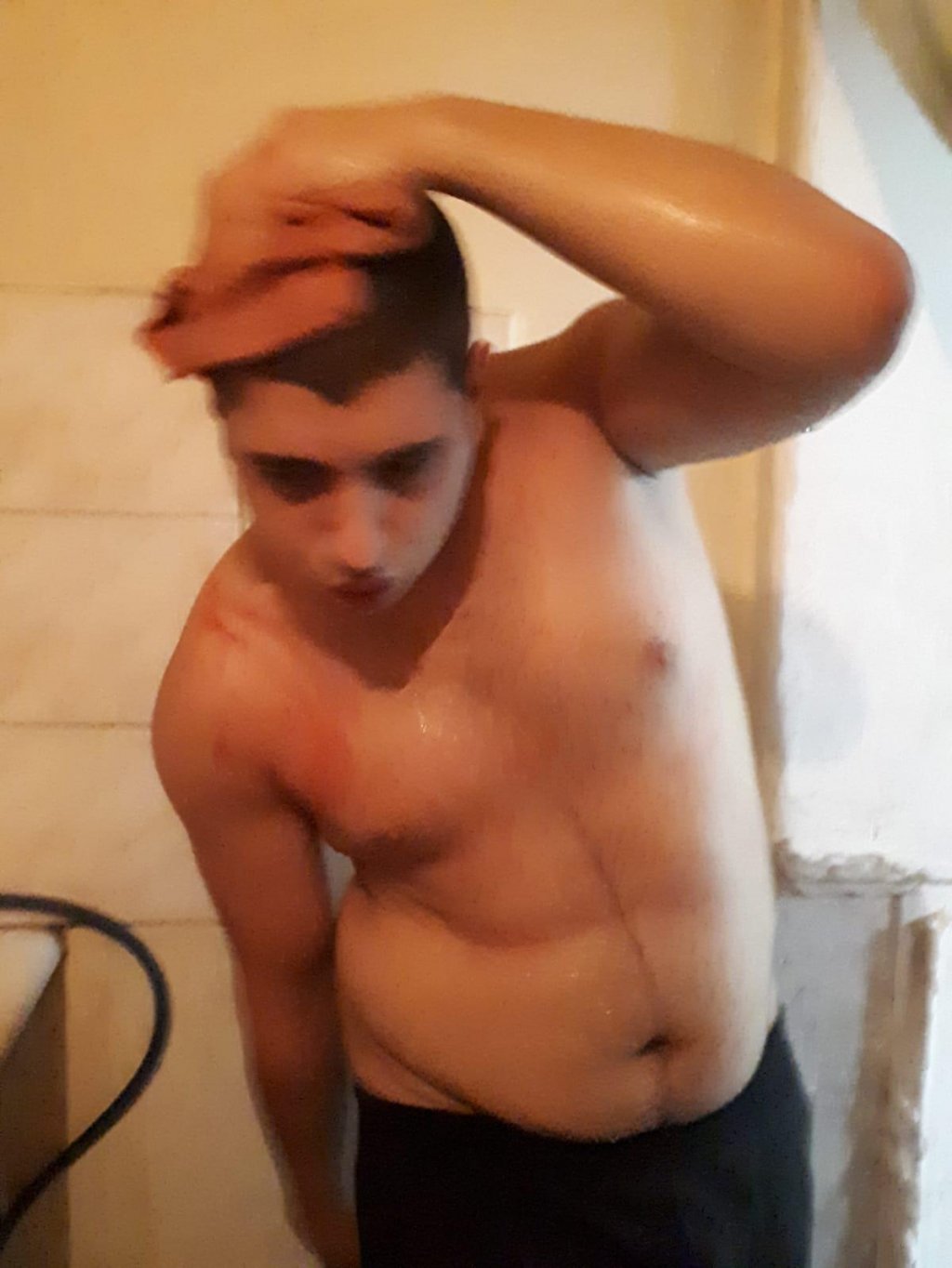 Eşinin amcası tarafından darbedilen kadın sosyal medyadan yardım istedi